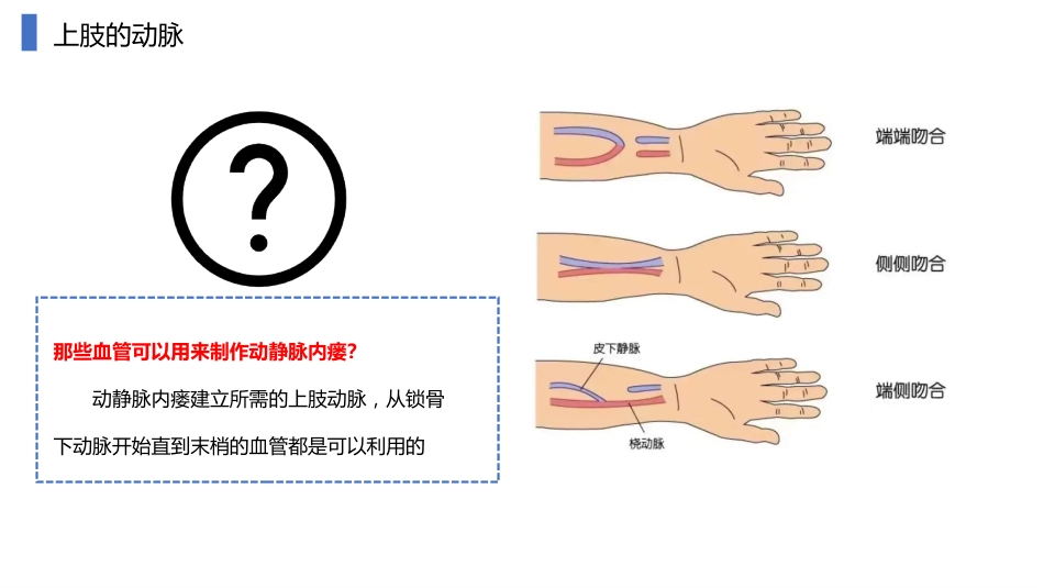动静脉内瘘血管解剖及穿刺技巧_第4页