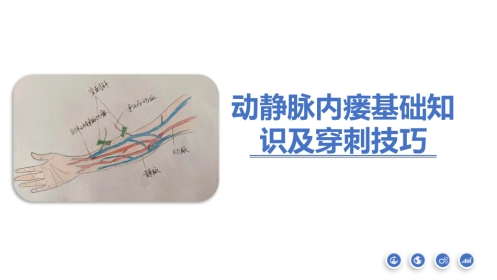 动静脉内瘘血管解剖及穿刺技巧