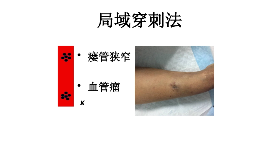 动静脉内瘘穿刺及维护_第12页