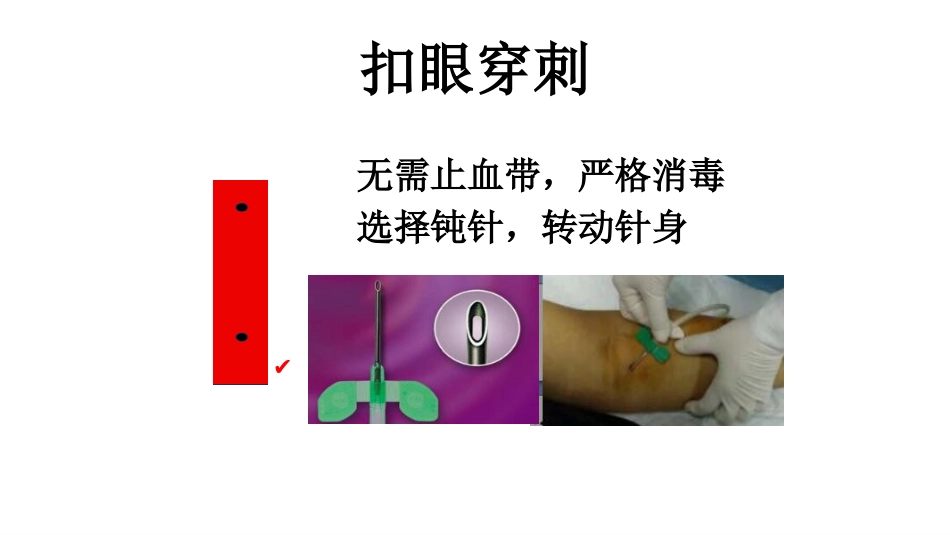 动静脉内瘘穿刺及维护_第13页