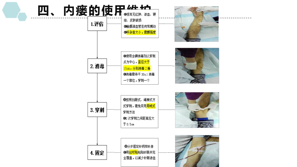 动静脉内瘘穿刺及维护_第15页