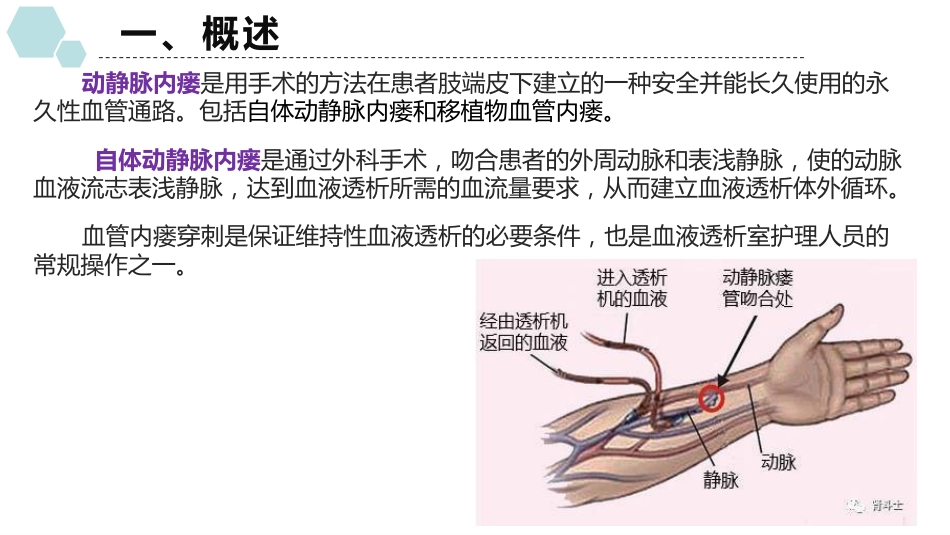 动静脉内瘘穿刺及维护_第3页