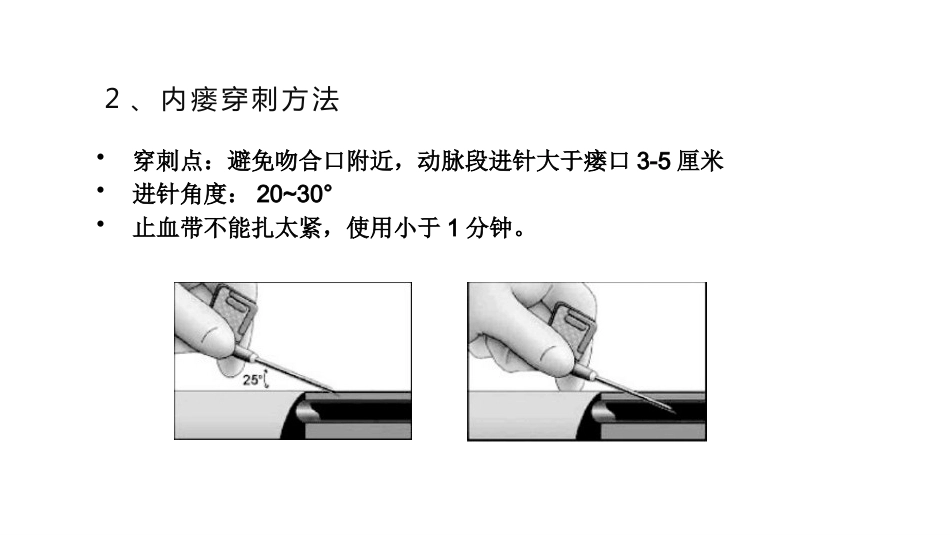 动静脉内瘘穿刺及维护_第9页