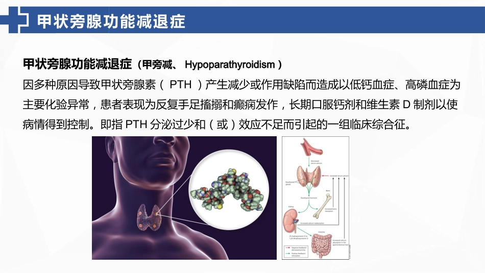 甲状旁腺功能减退症的护理_第6页