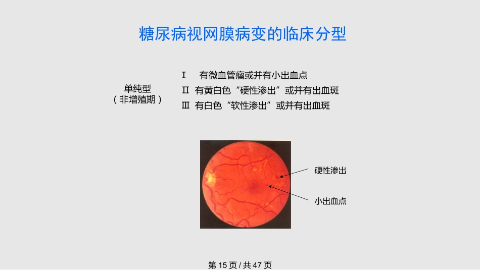 糖尿病慢性并发症及其防治PPT课件_第15页