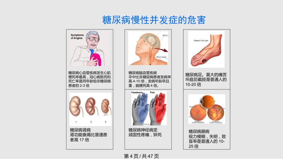 糖尿病慢性并发症及其防治PPT课件_第4页