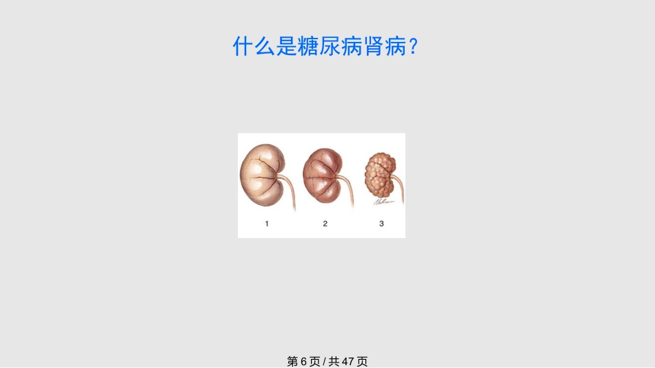 糖尿病慢性并发症及其防治PPT课件_第6页