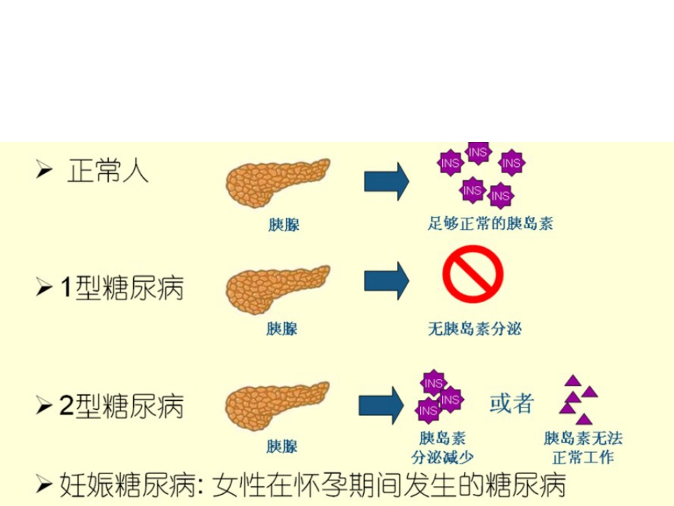 《糖尿病用药》PPT课件_第3页