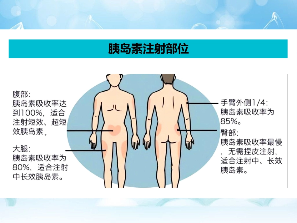 科普-怎样注射胰岛素(图示)_第14页