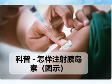 科普-怎样注射胰岛素(图示)