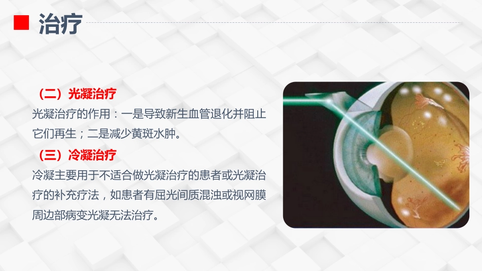 糖尿病视网膜病变患者护理查房_第14页