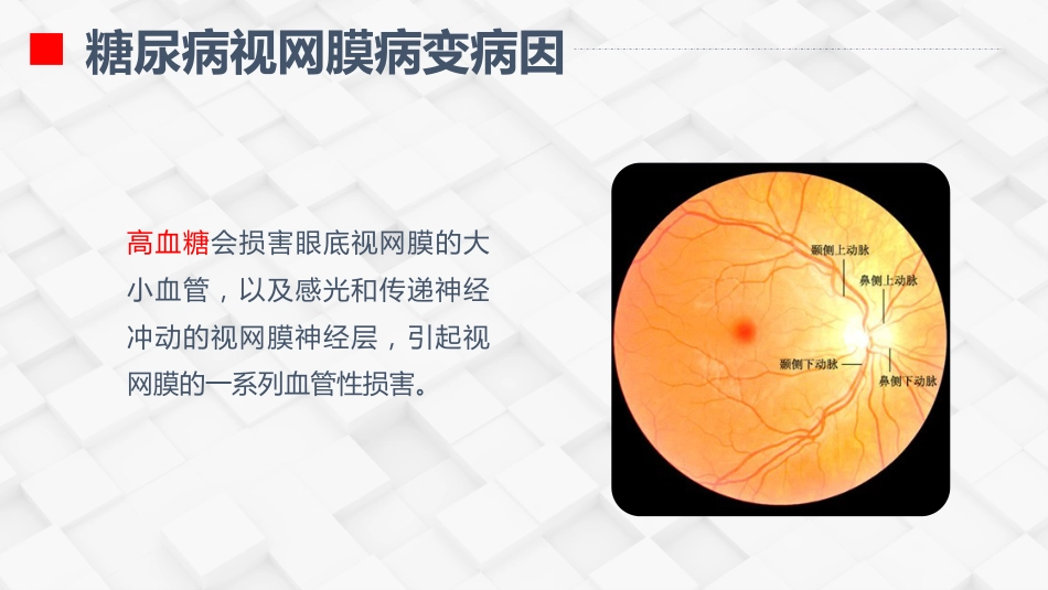 糖尿病视网膜病变患者护理查房_第5页
