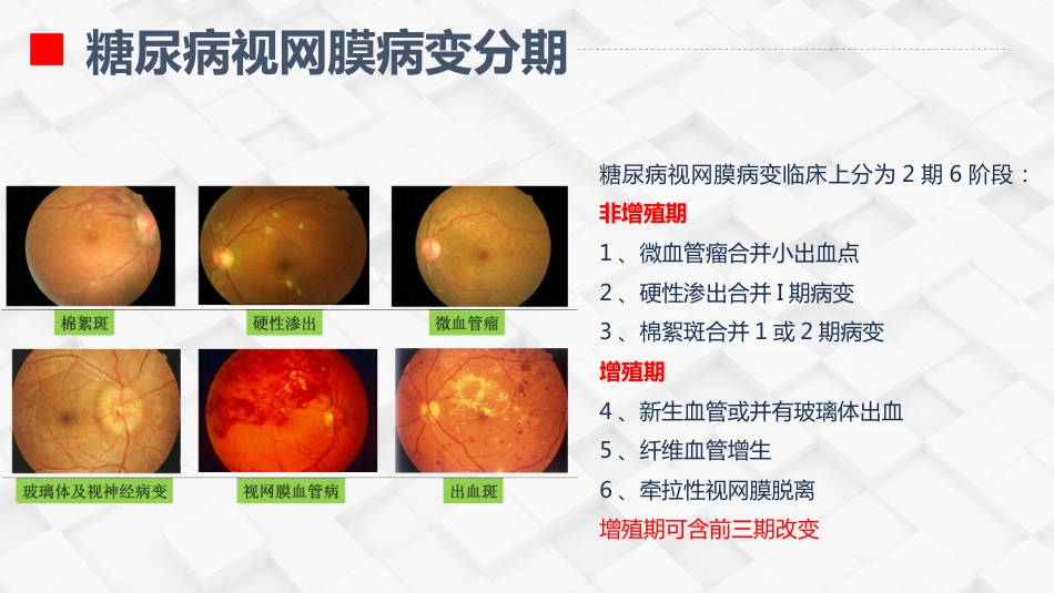 糖尿病视网膜病变患者护理查房_第6页