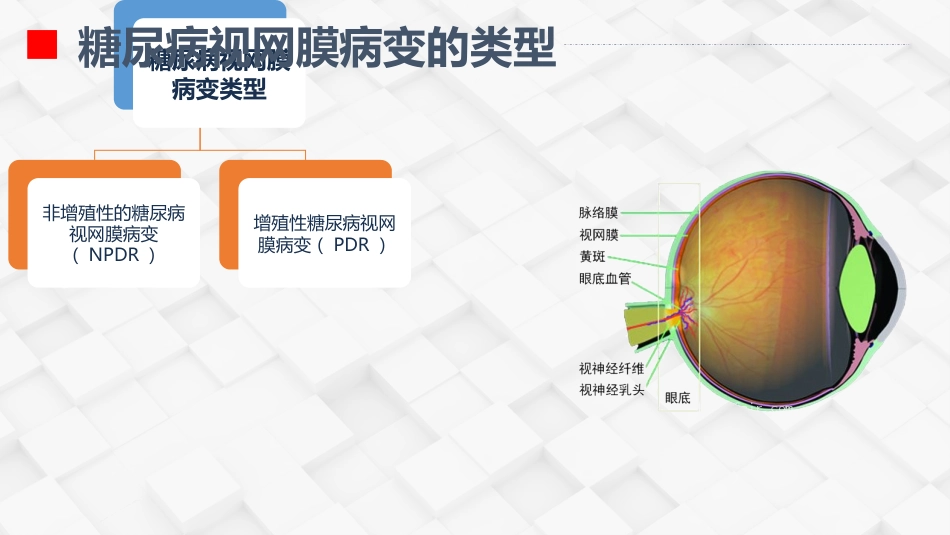 糖尿病视网膜病变患者护理查房_第7页