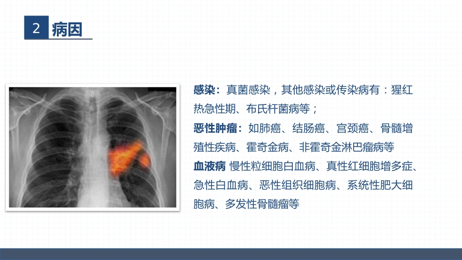 血液内科-嗜酸细胞增多症的护理查房_第7页