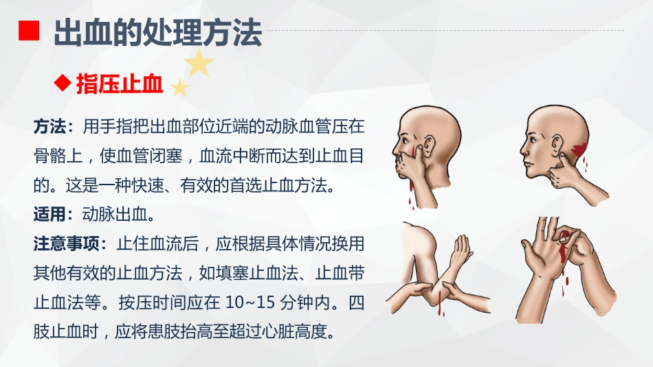 出血的观察和护理_第13页