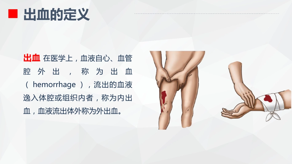 出血的观察和护理_第4页