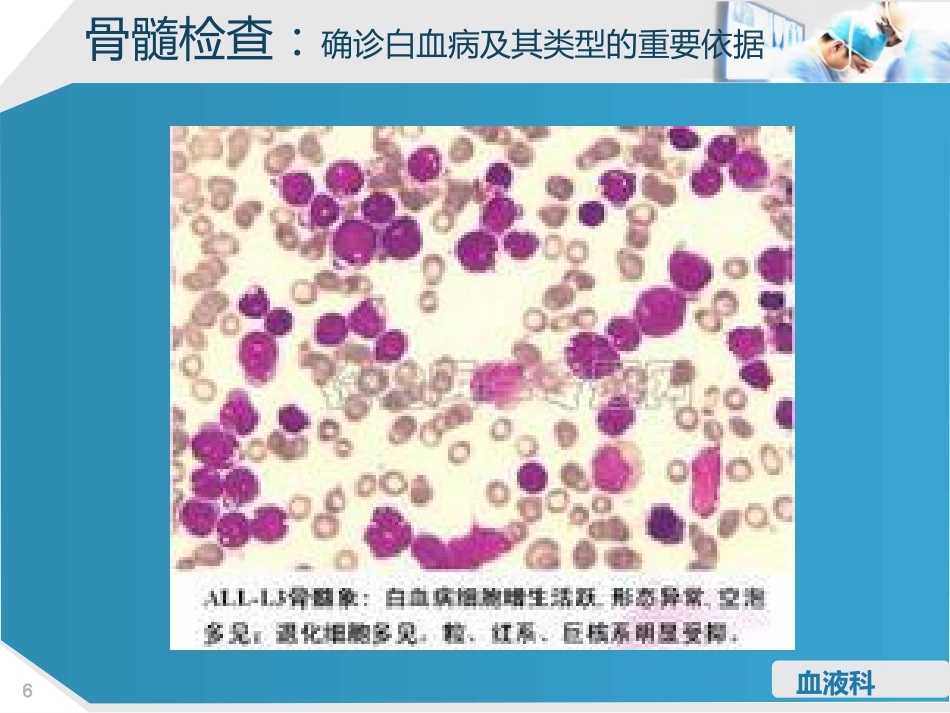 淋巴细胞性白血病的护理查房_第6页