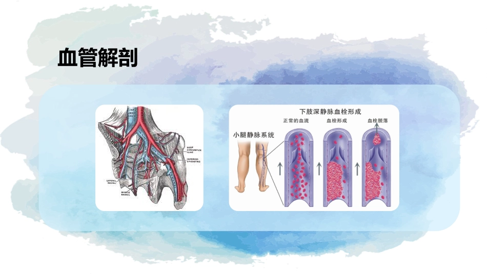 下肢静脉血栓的护理查房_第11页
