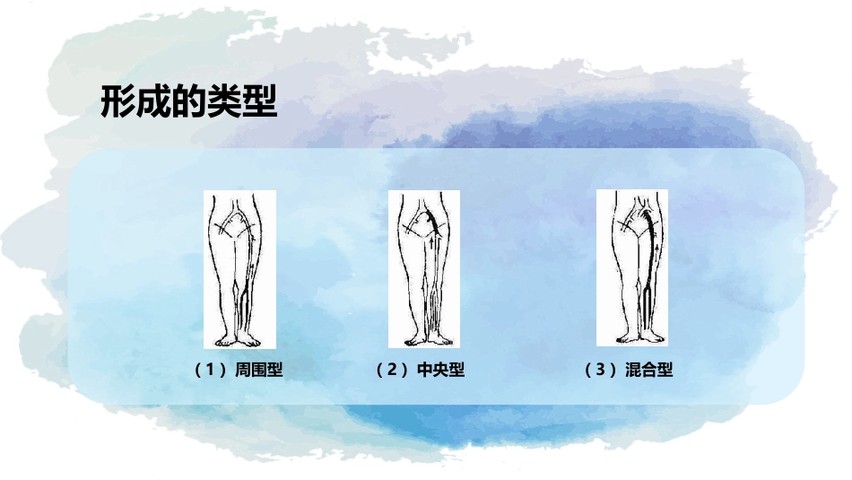 下肢静脉血栓的护理查房_第15页
