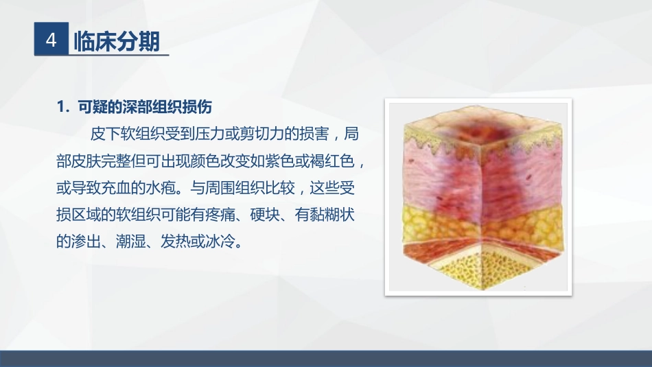 压疮的护理_第10页