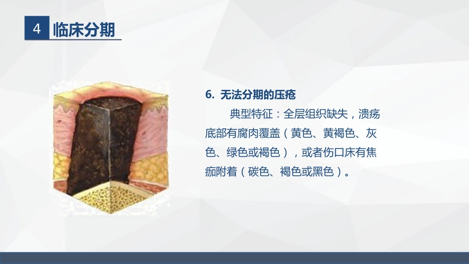 压疮的护理_第15页