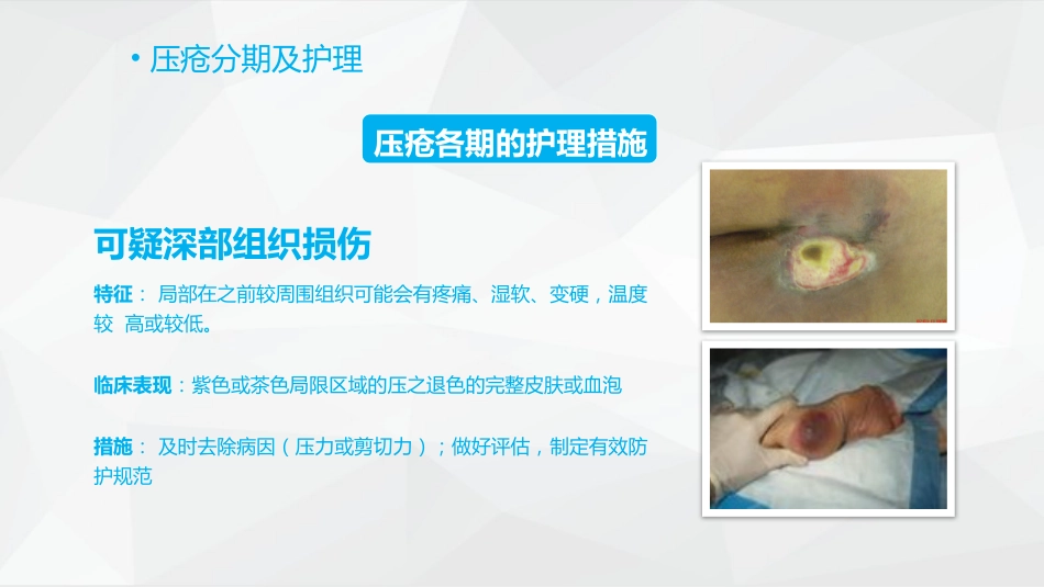 压疮护理_第14页