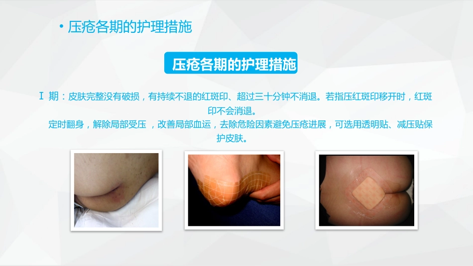 压疮护理_第15页
