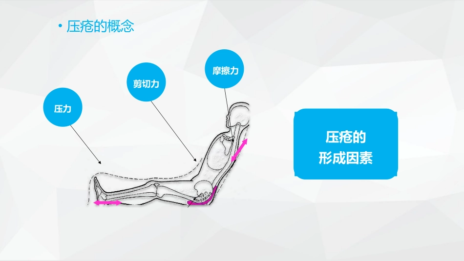 压疮护理_第6页