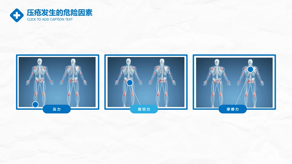 医学医疗压疮护理_第6页