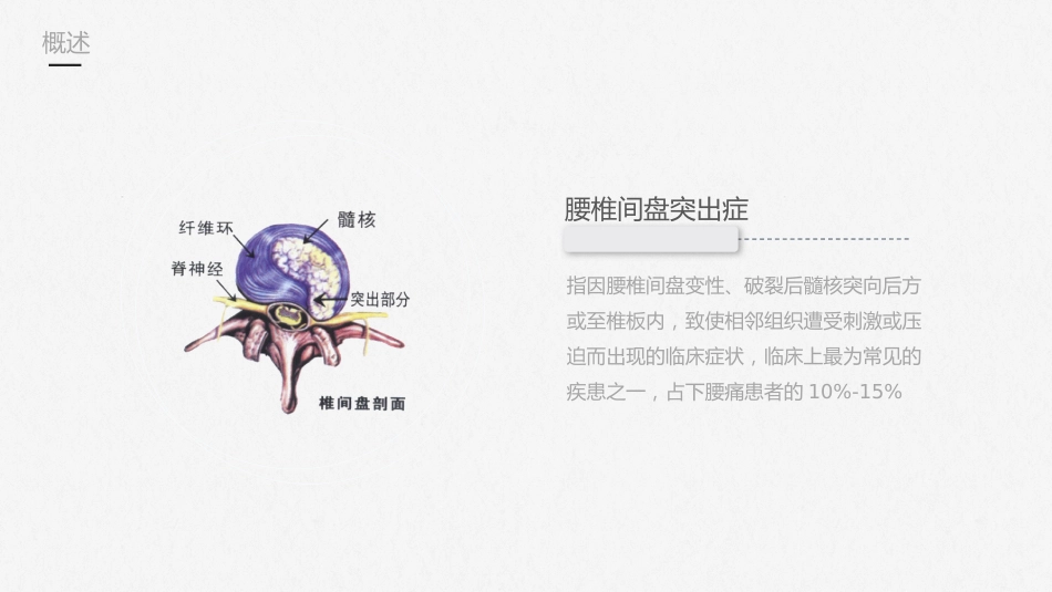 腰椎间盘突出症护理查房-模板参考_第4页