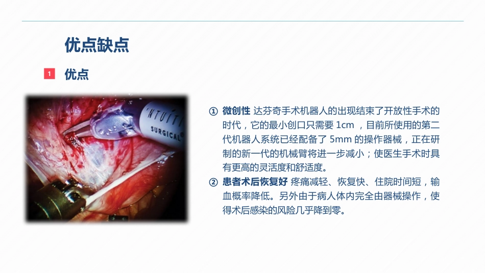 达芬奇手术机器人的手术配合_第11页