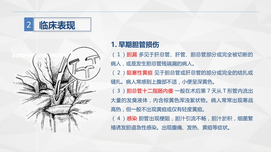 胆道损伤的护理-业务学习_第10页
