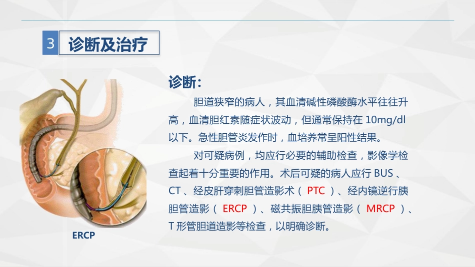 胆道损伤的护理-业务学习_第12页