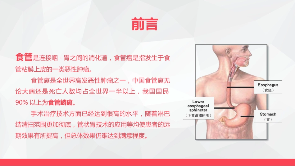 局部晚期食管癌新辅助治疗_第4页