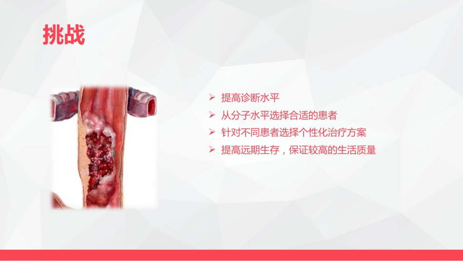 局部晚期食管癌新辅助治疗_第5页