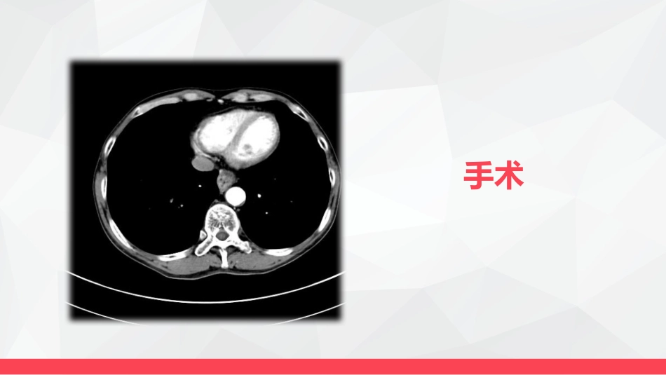 局部晚期食管癌新辅助治疗_第6页