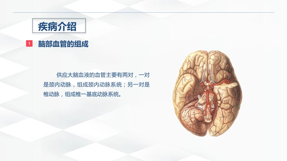 脑出血的术后护理_第4页