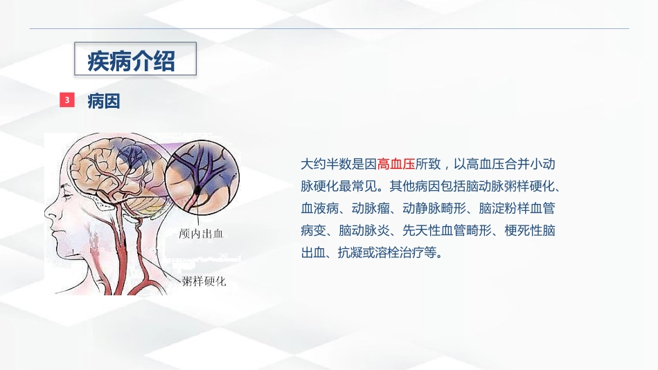 脑出血的术后护理_第6页