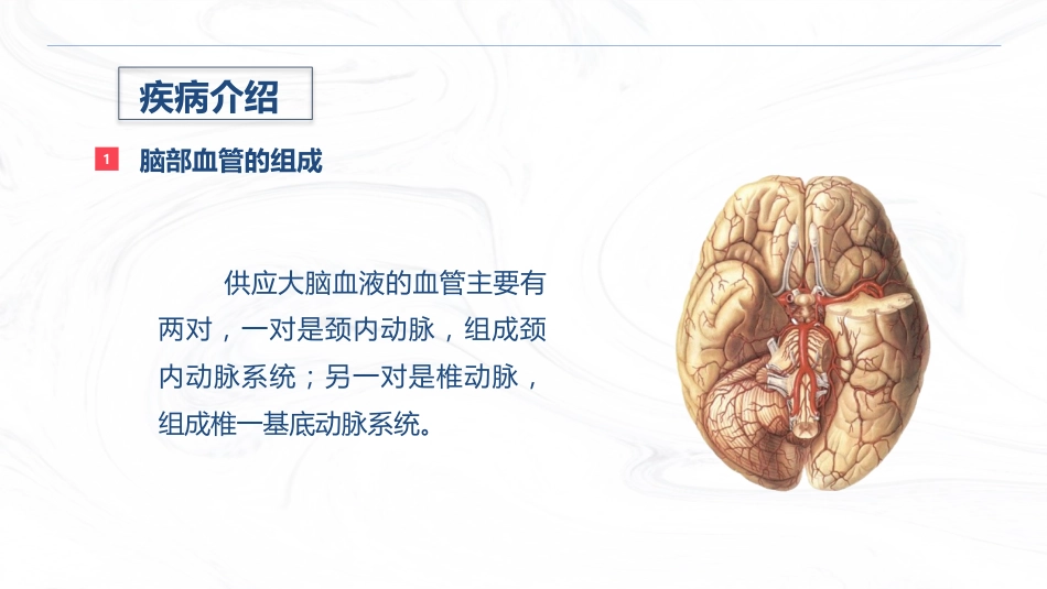 脑出血疾病介绍+术后护理_第4页