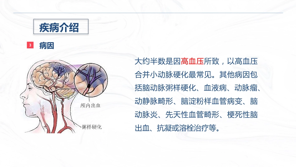 脑出血疾病介绍+术后护理_第6页