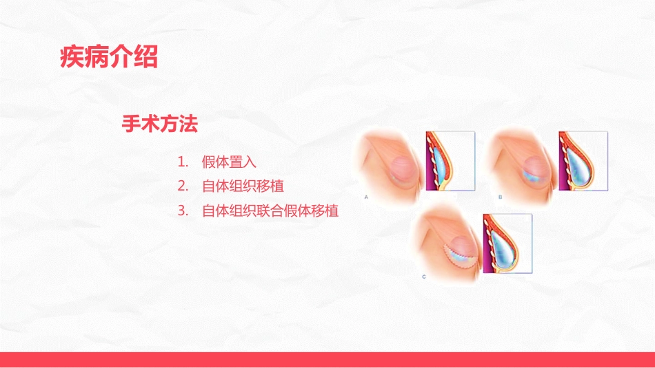 乳腺癌乳房重建术后的护理_第5页