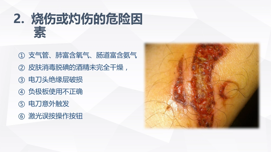 手术室的护理安全_第10页