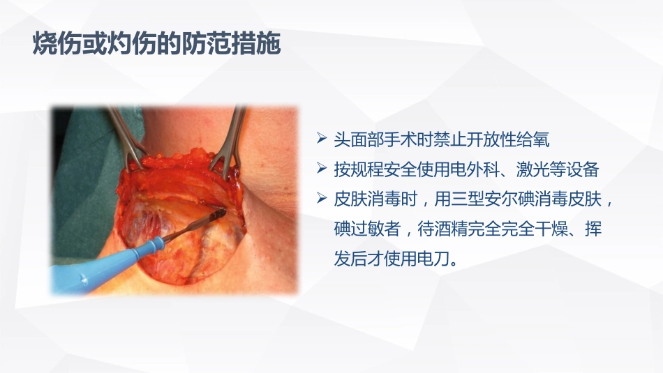 手术室的护理安全_第11页