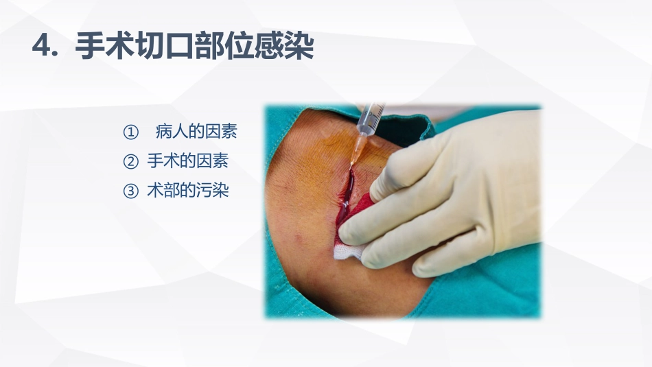 手术室的护理安全_第15页