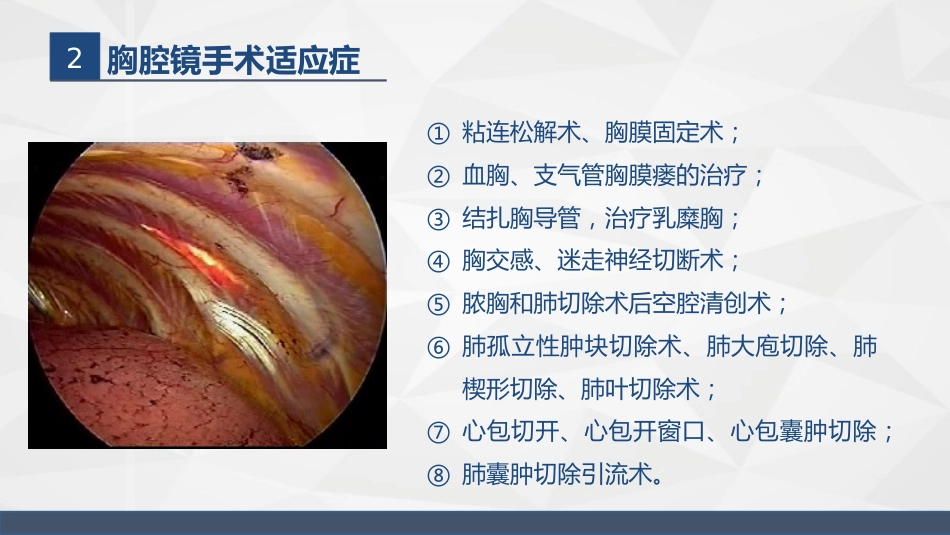 胸腔镜在胸外科的临床应用_第11页