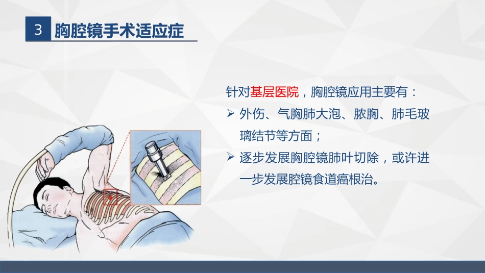 胸腔镜在胸外科的临床应用_第12页
