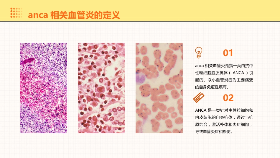 anca相关血管炎诊治进展PPT课件_第7页
