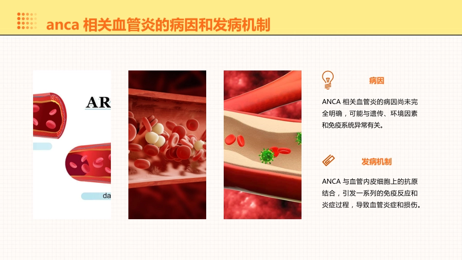 anca相关血管炎诊治进展PPT课件_第8页