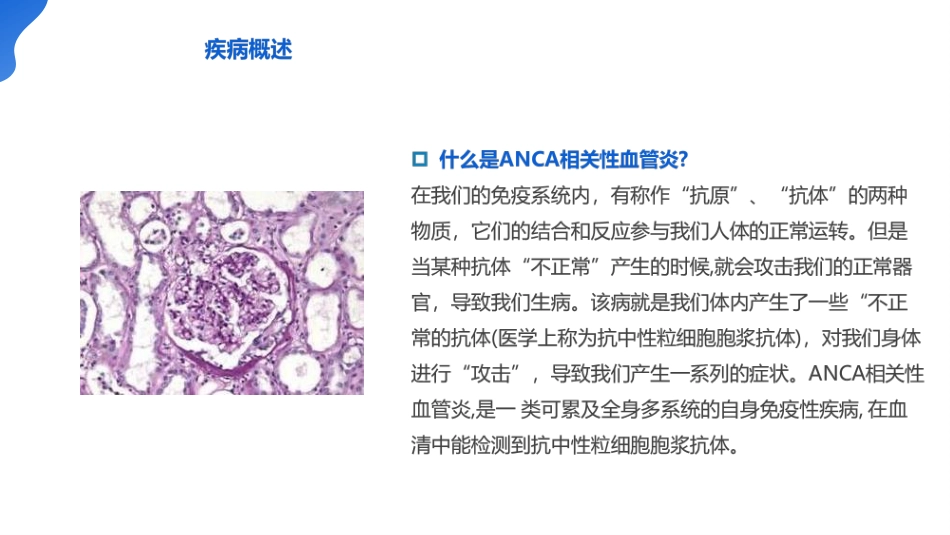 ANCA相关血管炎诊断标准ppt_第4页